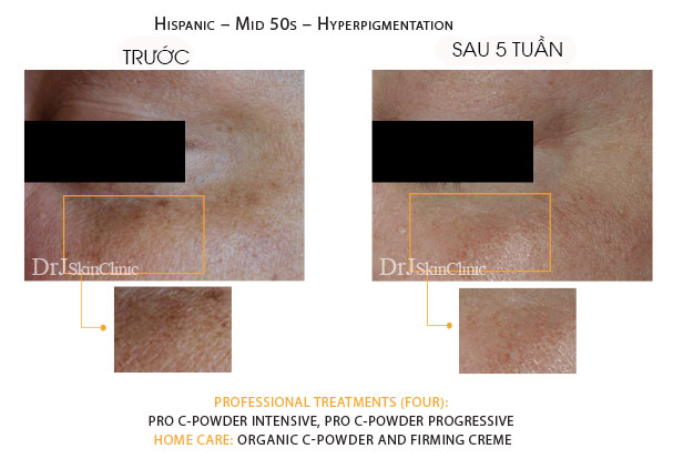 Huyết thanh vitamin C hữu cơ DrJ Skinclinic Organic C-Powder Kit 9