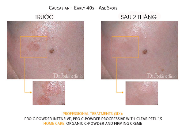 Huyết thanh vitamin C hữu cơ DrJ Skinclinic Organic C-Powder Kit 10