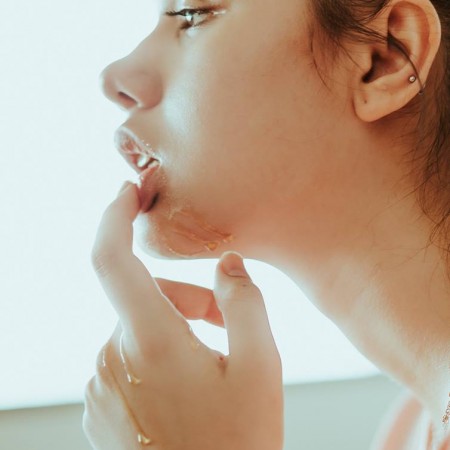 Mụn nội tiết và cân bằng nội tiết tố (Series bài viết ngắn)
