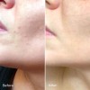 Kem dưỡng phục hồi da Luxe Botanics KIGELIA CORRECTIVE MOISTURISER mini 3