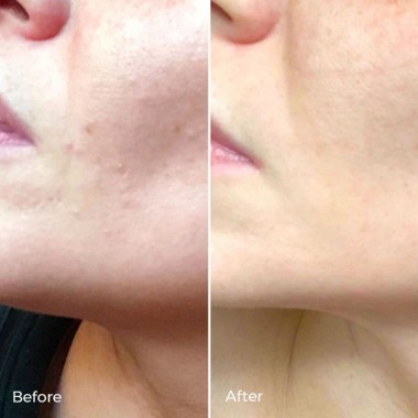 Kem dưỡng phục hồi da Luxe Botanics KIGELIA CORRECTIVE MOISTURISER mini 1