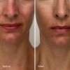 Kem dưỡng phục hồi da Luxe Botanics KIGELIA CORRECTIVE MOISTURISER mini 4