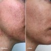 Serum phục hồi da Luxe Botanics KIGELIA CORRECTIVE SERUM mini 4