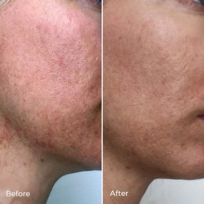 Serum phục hồi da Luxe Botanics KIGELIA CORRECTIVE SERUM mini - Ảnh 3