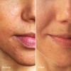 Serum phục hồi da Luxe Botanics KIGELIA CORRECTIVE SERUM mini 5