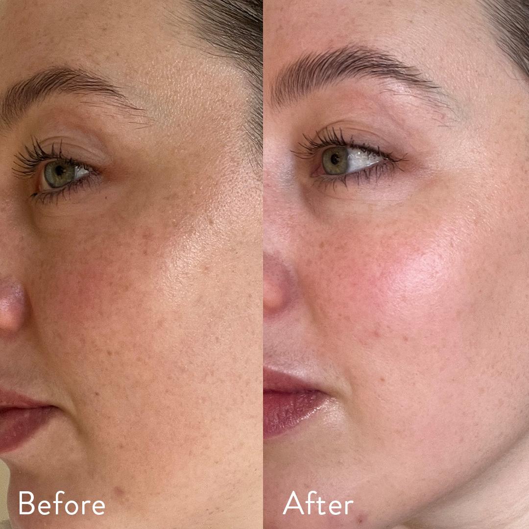 96% người dùng thấy cải thiện khi dùng Collagen Nutra Organics