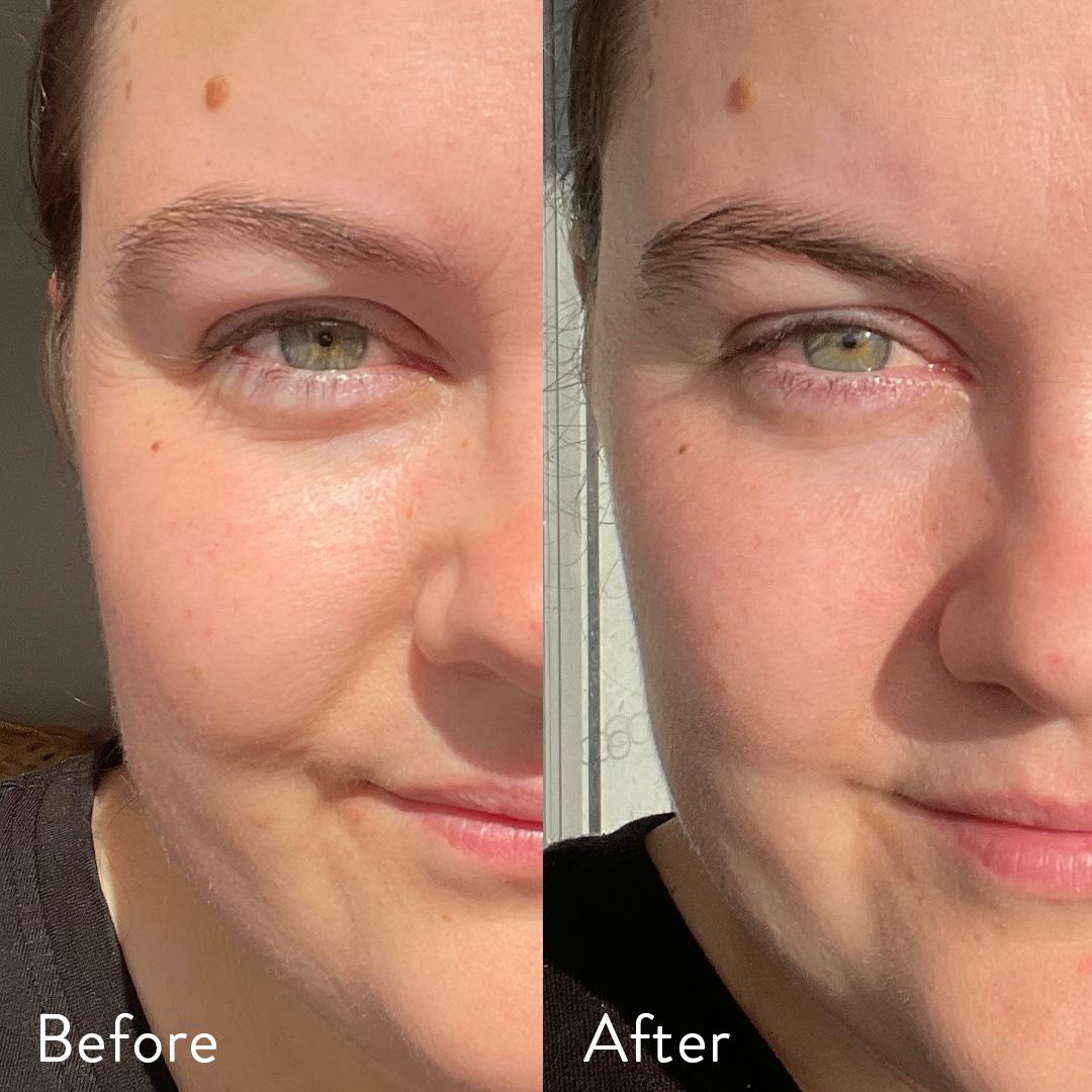 96% người dùng thấy cải thiện khi dùng Collagen Nutra Organics