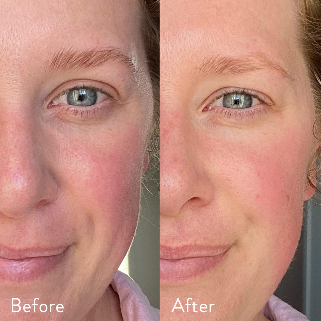 96% người dùng thấy cải thiện khi dùng Collagen Nutra Organics