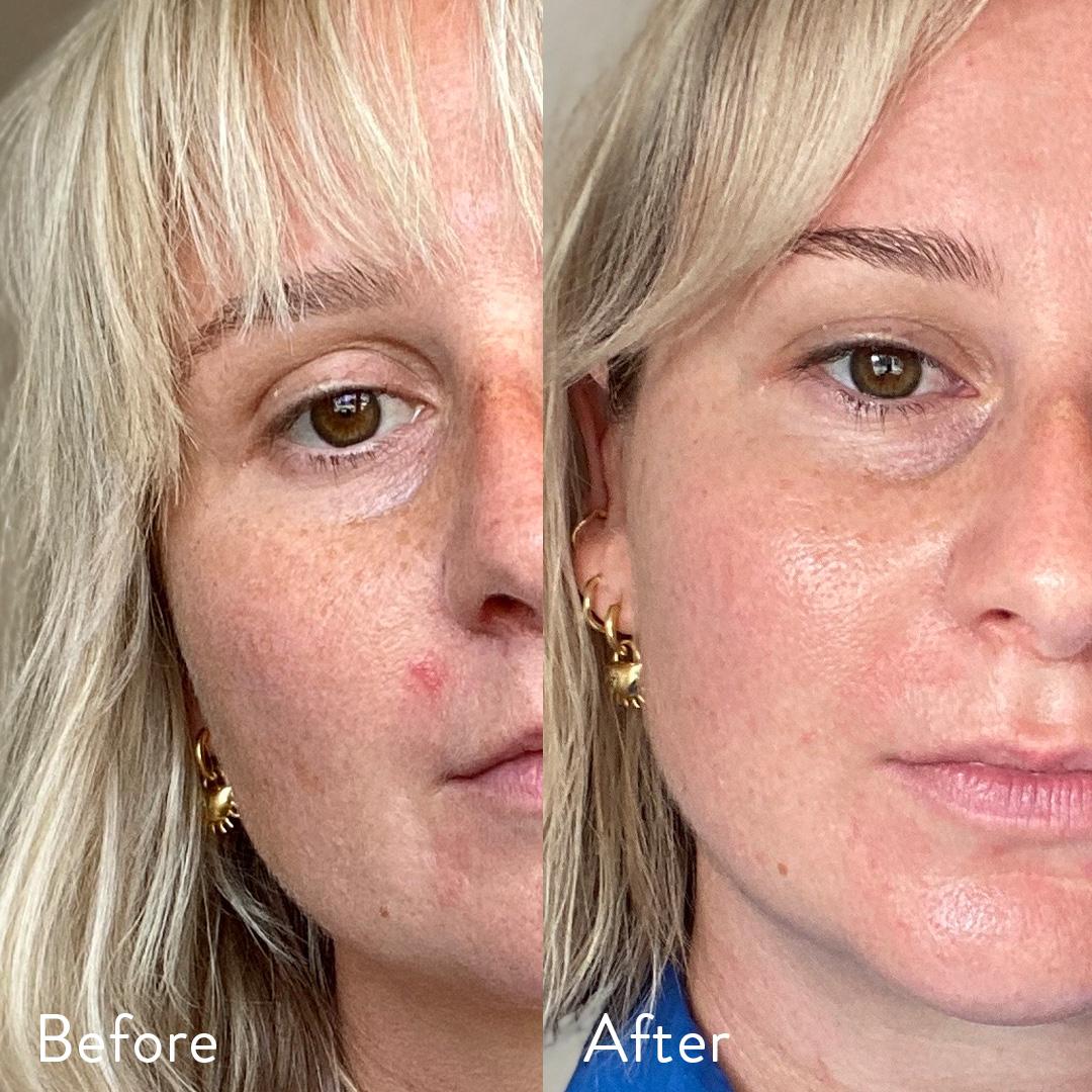 96% người dùng thấy cải thiện khi dùng Collagen Nutra Organics